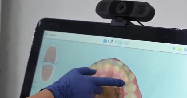 Digitaler iTero-Abdruck bei SDS Dental