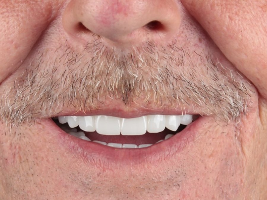 After treatment, close-up