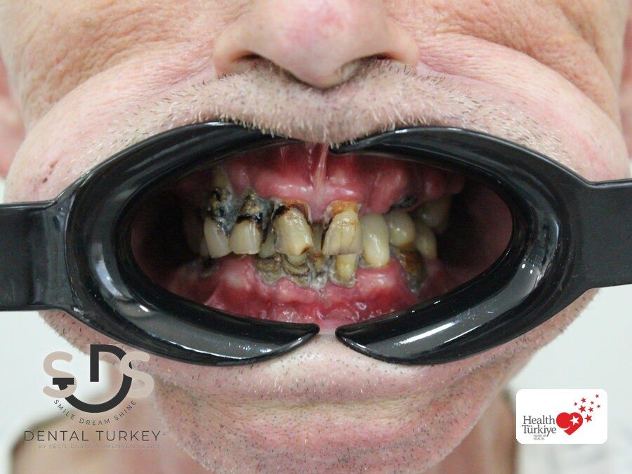 Before treatment, close-up