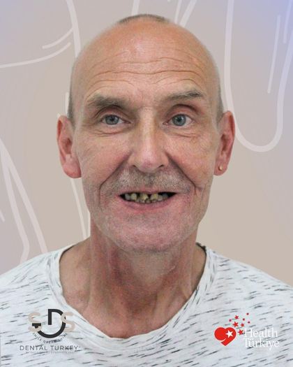 Vor der Behandlung