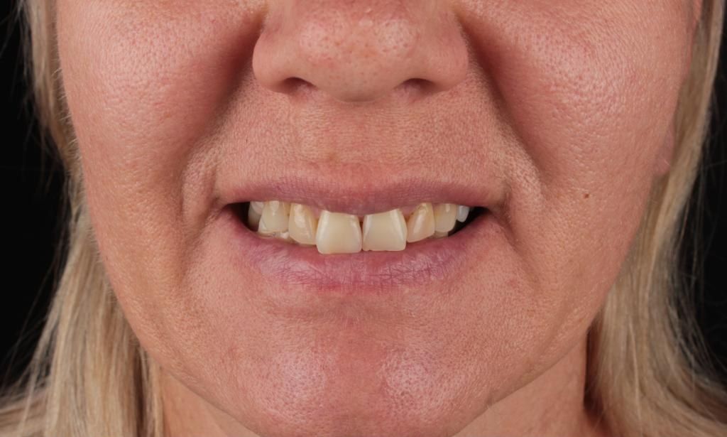 Before treatment, close-up