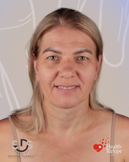 Vor der Behandlung