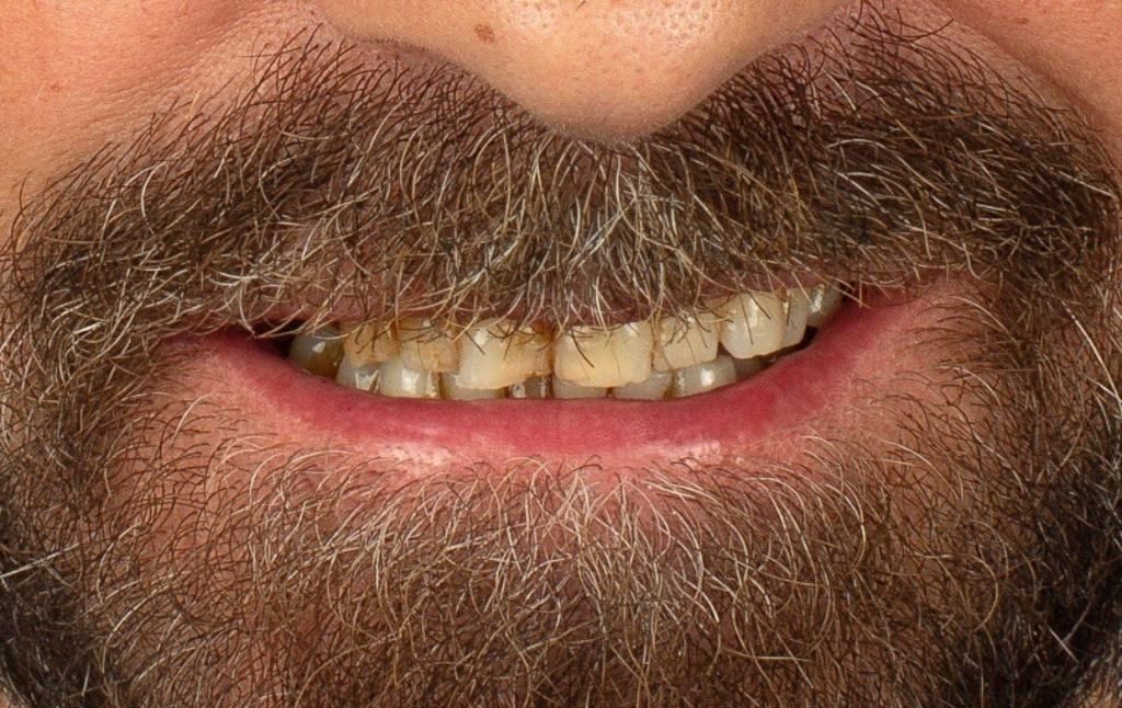 Before treatment, close-up
