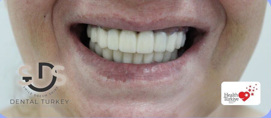 After treatment, close-up