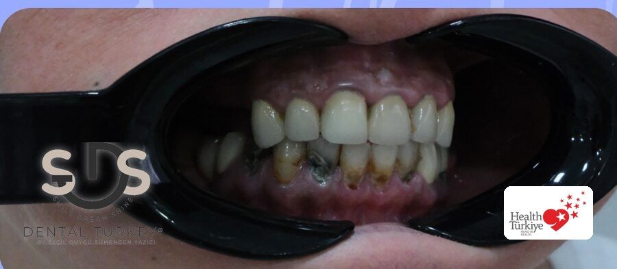 Before treatment, close-up