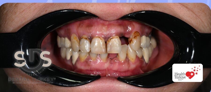 Before treatment, close-up