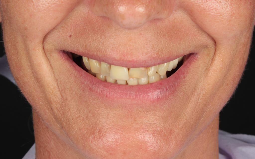 Before treatment, close-up