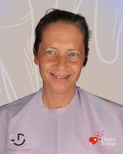 Vor der Behandlung