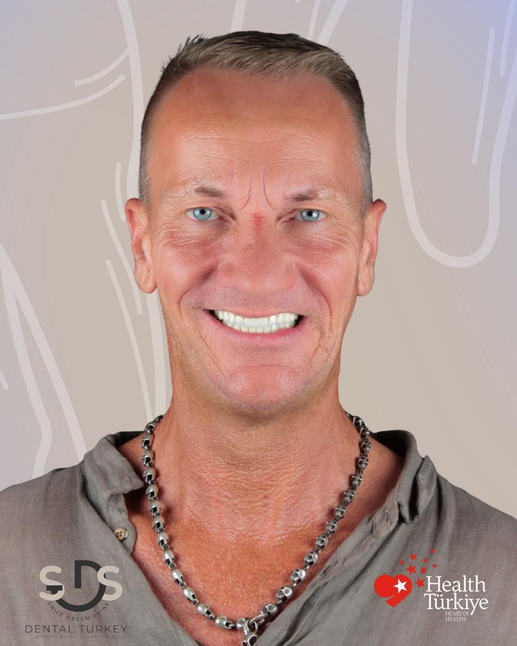 After treatment, face view