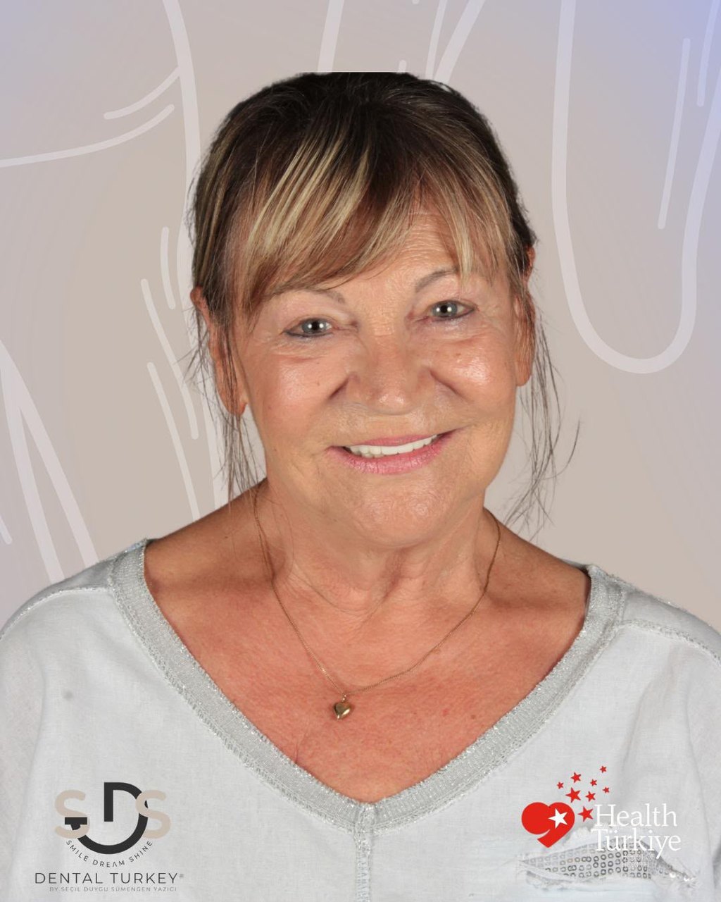 After treatment, face view