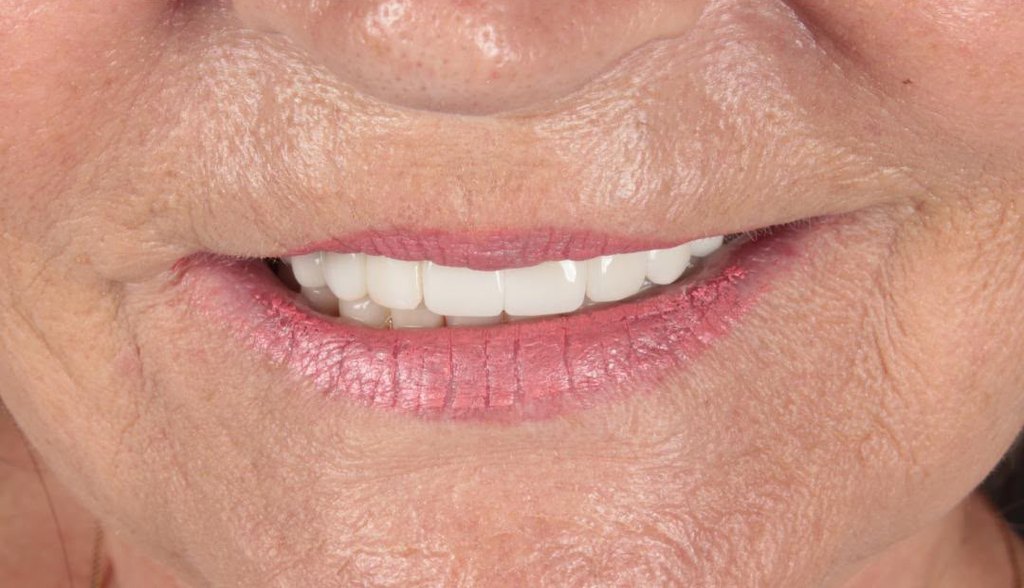 After treatment, close-up