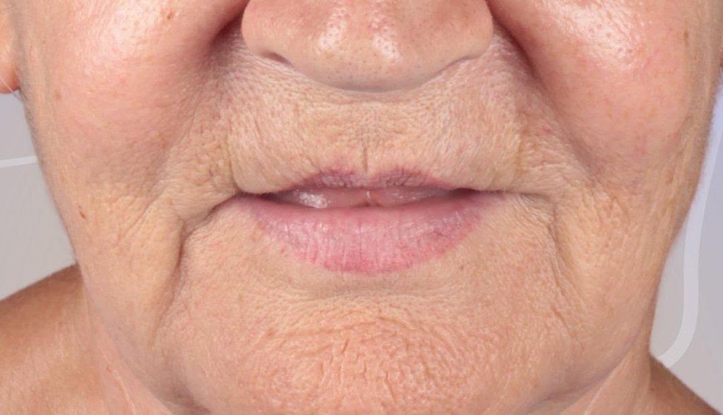 Before treatment, close-up